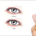 Allure contact lenses with dark outer ring highlights the eye